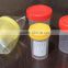 lab vacuum urine test container urine specimen bottles