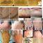 Laser Machine For Tattoo Removal Q-Switched ND YAG Laser Melasma / Laser Removal Tattoo Machine Cloasma And Nevus Of Ota Removal