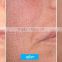 Remove Tiny Wrinkle Tattoo /lip Line Removal Acne Treatment Skin Rejuvenation Skin Tightening Co2 Laser Fractional CO2 Laser Equipment Pigment Removal Acne Treatment Wart Removal Arms / Legs Hair Removal