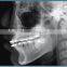 Dental Digital Panoramic and Cephalometric X-ray Machine