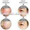 intense pulse light home hair removal machine company look for agent