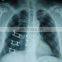 Spine Implants Medical Nitinol Sheet shape memory alloy sheet