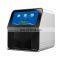 SMT120 high quality clinical hospital laboratory portable fully automatic blood chemistry analyzer