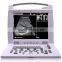 Laptop vet ultrasound scanner devices for various animal test use 3018vp