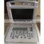 HC-A004 Cheapest Good Quality Medical Full Digital Portable Laptop B/W Ultrasound Scanner for Pregnancy