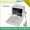 Sonostar High Quality Portable Black and White 12 Inches LCD Screen Ultrasound Machine Sale SS-4