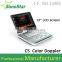 3D 4D Portable Color Doppler Ultrasound System