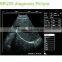 Black and white images digital portable ultrasound machine price Manufacture Supplies- BPU09