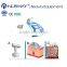 No Pain Portable Slimming 2016 High Intensity Eye Lines Removal Focused Ultrasound Hifu Therapy Hifushape HIfu Slimming Machine