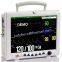 Ce Medical Equipment 12-дюймовый портативный многопараметрический монитор пациента для интенсивной терапии