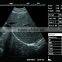 Sonostar 3D Built-in Battery Portable Vascular Cheapest Ultrasound Machine