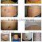 Cryolipolysis Slimming Machine /cryo Skin Tightening Fat Reduce /lose Weight Machine Fat Reduction
