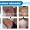2016 new professional 12 laser bars 808nm diode laser hair removal machines from israel