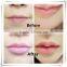 Perfect Lip Lip Pump/lip Enhance /lip Plump Lip Enhancement