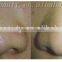 Handheld diamond microdermabrasion blackhead vacuum with CE approval
