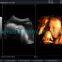 Premium 4D Color Doppler Ultrasound Scanner