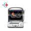 Cheapest Original Sonoscape S8 Portable 4d Color Doppler Ultrasound/Sonoscape Ultrasound