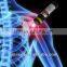 Arthritis laser equipment / Portable acupuncture laser equipment