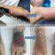 Apolomed floor standing q switch nd yag laser for tattoo removal and skin rejuvenation yag laser
