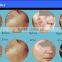 Medical Professional Co2 Fractional Laser / Laser Co2 Fractional Laser Scar Removal Beauty Equipment Wanted Mole Removal