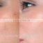 immediately effect vein remove device/vein clearance machine/vascualr removal machine immediate result