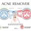 home skin care beauty equipment Acne removal and facial pore cleaner