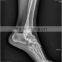 hot selling good quality Konida use medical laser x-ray fuji dry film