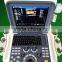 MC-DU-06 Portable Color Doppler Ultrasound Scanner