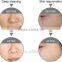 Relieve Skin Fatigue Dispel Chloasma Portable Rejuvenation And Skin Care Hyperbaric Oxygen Skin Treatment Machine Water Oxygen Jet Peel Machine Water Facial Peeling Improve Skin Texture