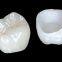 Porcelain Fused to Metal Lab from China