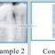 Dental X-Ray Unit (standing Type)
