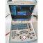 HOT SALE New type ultrasound machine Mindray scanner DP-10 with CE certificates