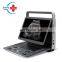 Portable Laptop Sonoscape E2 Ultrasound Machine Color Doppler Ultrasound Device System