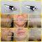 Fractional rf microneedle wrinkle removal skin tightening face lifting facial beauty machine