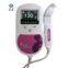 Sonoline C Fetal Doppler -- CE Approved