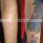 Manufactory Portable nd yag tattoo removal laser with medical CE in cheapest