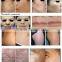 Co2 Laser Vaginal Tightening Rejuvenation Treatment/co2 Fractional Laser Skin Care Device