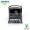 medical Modern Design b/w 2d portable ultrasound Chison eco 1