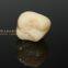 Dental crown solid zirconia bruxzir, dental teeth, laboratoire dentaire, Dentallabor, laboratorio dental, dental laboratory, Shenzhen LJ dental lab China