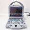 HC-A012A Hot Sale Full digital portable Doppler Color Ultrasound scanner
