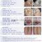 Ipl Beauty Equipment IPL Hair Removal Skin Rejuvenation
