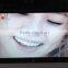 7" 8" 10" 12" 15" inch WIFI photo frame digital