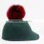Myfur Genuine Fox Fur Pompoms with Snow Top Red Fox Fur Ball Accessory
