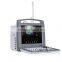Full-digital Color Doppler Ultrasound cardiac 3D doppler ultrasound