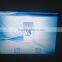 Long Pulsed 532/1064 NdYag Vascular Laser