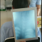Portable Diagnostic X-Ray Machine
