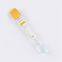 CE Gel&Clot Yellow Lid Disposable Blood Collection Tube