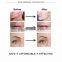 2016 Newest 4 in 1 derma roller 300 720 1200 needles stainless micro needle therapy derma roller dermaroller anti wrinkle creme