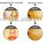 beauty equipment with IPL system to remove pore,acne, wrinkles, freckles