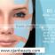 2016 Summer HIFU High Intensity Focused Ultrasound Skin Eyes Wrinkle Removal Rejuvenation Machine /hifu Facial Rejuvenation Machine 2000 Shots